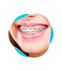 metallokeramicheskie-koronki-preparirovanie