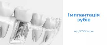 simptomy-posle-udaleniya-zuba-mudrosti-nizhnego2