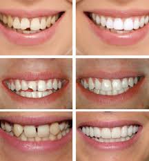 voda-uhubr-12